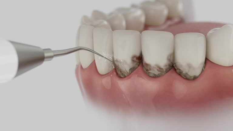 Reliable Emergency Dentist contractor in Cinco Ranch, TX by Smile Center Dentistry